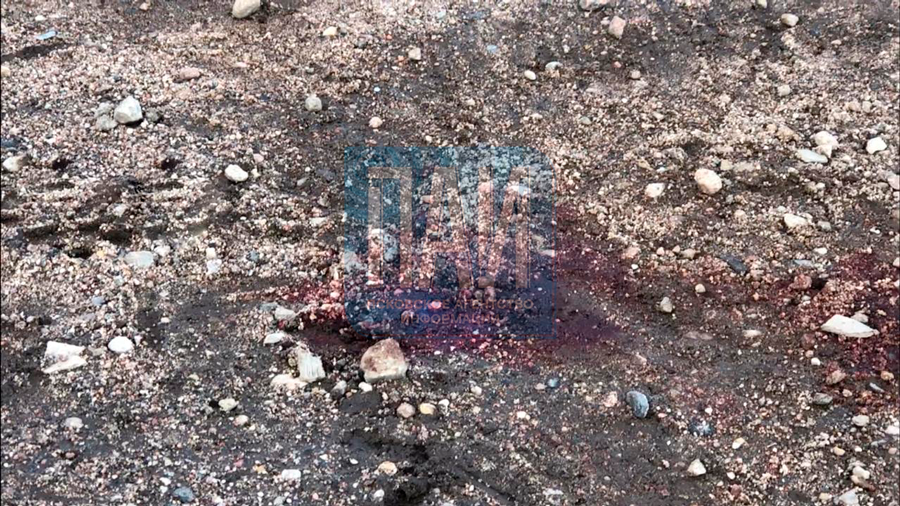 Подростка сбили в деревне Родина