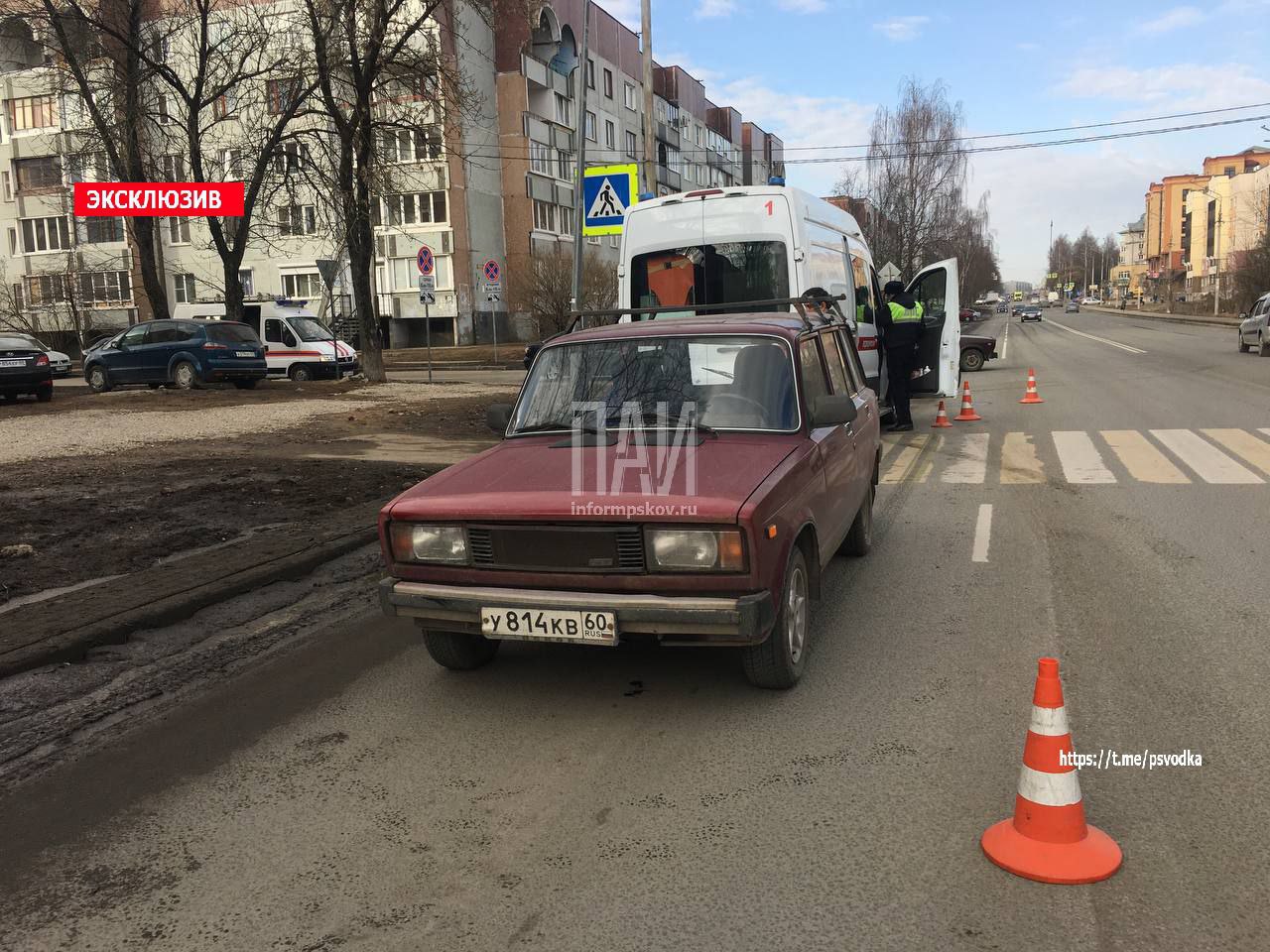 12-летний ребенок пострадал в результате наезда автомобиля в Пскове
