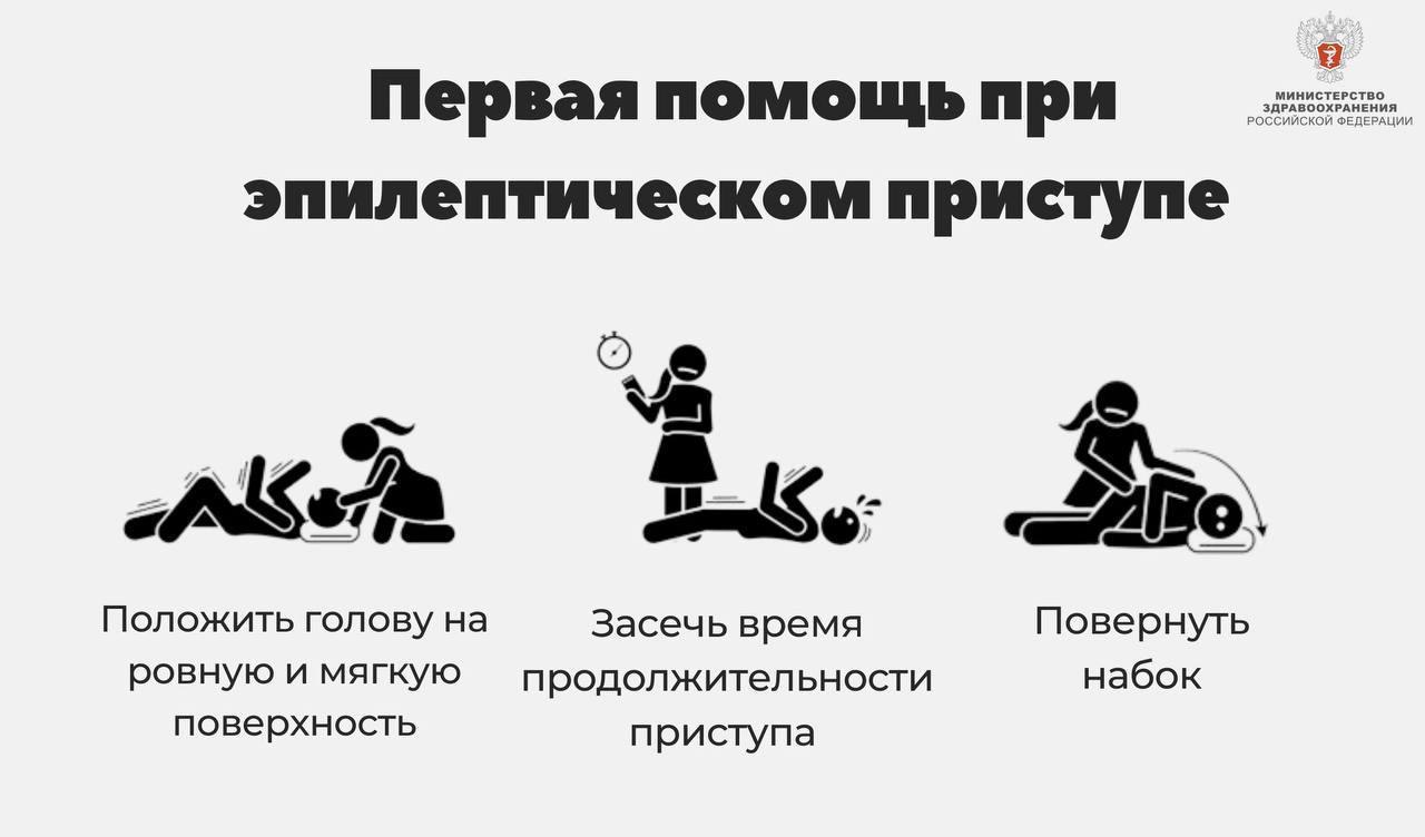 Приступ эпилепсии