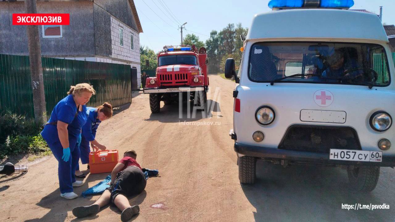 Автомобиль сбил 14-летнего мальчика в Стругах Красных