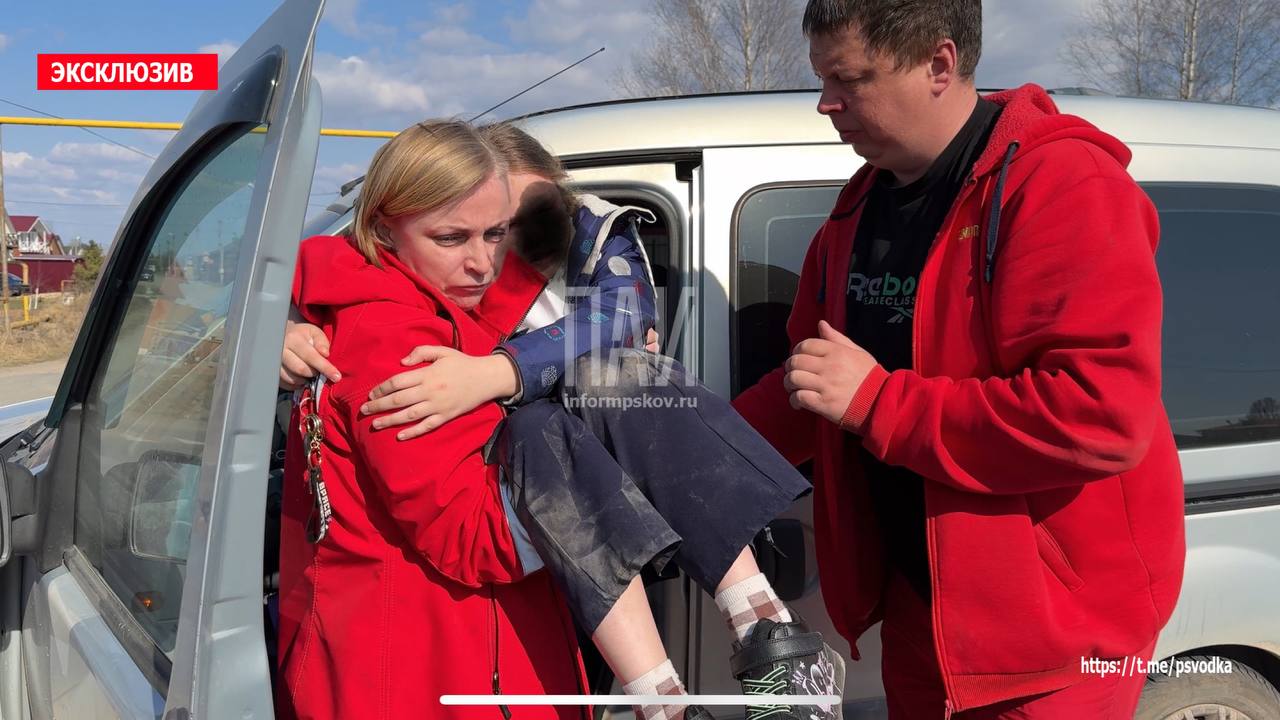 10-летнюю девочку сбили на пешеходном переходе в Псковском районе